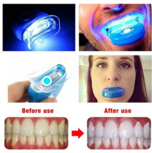 Blanqueador de Dientes- Renueva tu Sonrisa!!